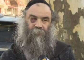 Victim of Brooklyn assault: Attacker said he hates Jews