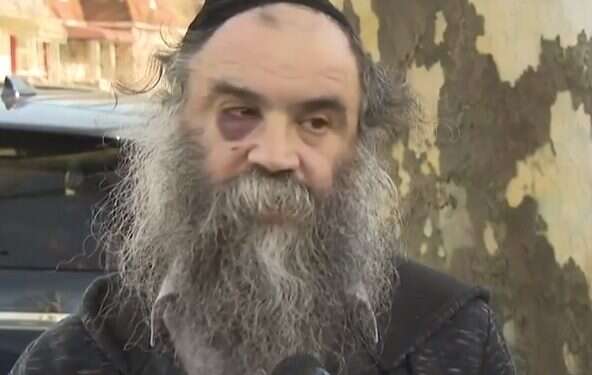 Victim of Brooklyn assault: Attacker said he hates Jews