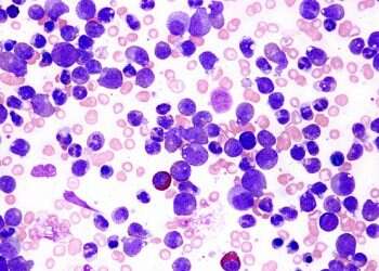 Israeli researchers develop groundbreaking leukemia drug