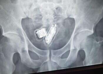 Terrorists smuggle phones in stomachs, prison service says