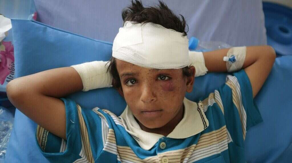 Over 7,500 kids killed or wounded in Yemen since 2013, UN reports