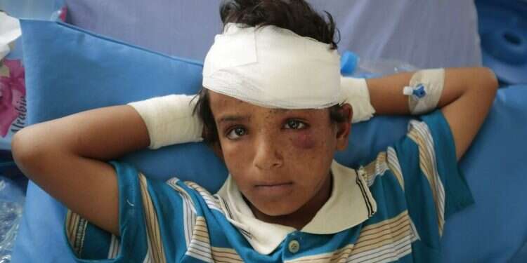 Over 7,500 kids killed or wounded in Yemen since 2013, UN reports