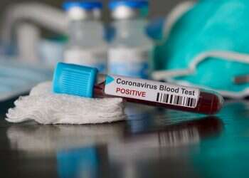 ADL: Extremists using coronavirus outbreak to stoke hatred against Jews
