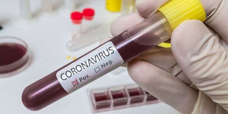 Israel is taking far-reaching steps to stem the outbreak Number of coronavirus patients in Israel exceeds 100
