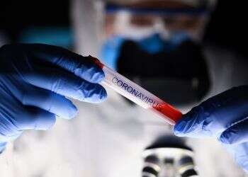 With over 2,600 confirmed cases, Israel has no exit strategy from corona crisis, official says