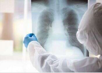 With over 3,000 corona cases, gov't mulls new emergency measures