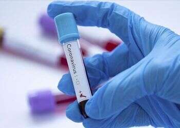 Coronavirus infection rate declining, expert says