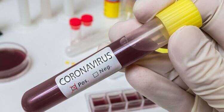 'Restrictions can be lifted only when we see drop to 10 cases a day'