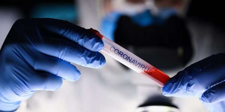 Israeli scientists develop 'series of coronavirus antibodies'