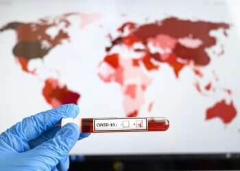 Coronavirus has not changed the Middle East