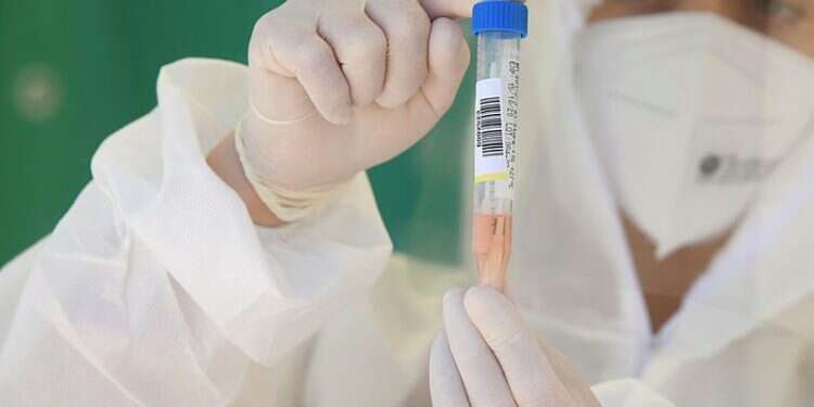 Nationwide COVID-19 serological testing to begin on Sunday