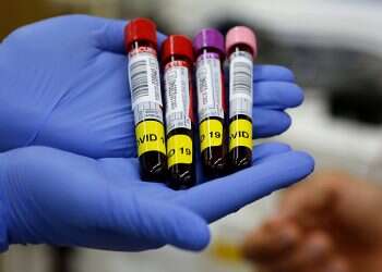 Aerospace Industries uses AI to forecast changes in COVID-19 patients