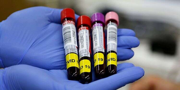 Aerospace Industries uses AI to forecast changes in COVID-19 patients