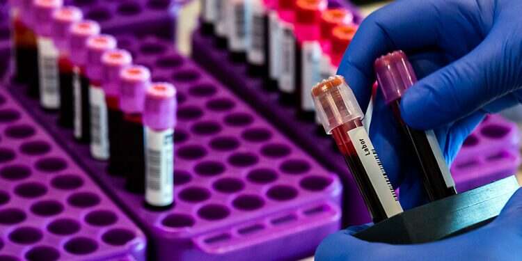 While 839,430 Israelis have recovered from the virus since the onset of the pandemic, 6452 have died Israel 'far from herd immunity' to coronavirus, new study shows