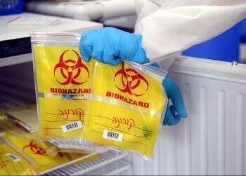 Exhausted staff at corona testing labs threatens labor dispute