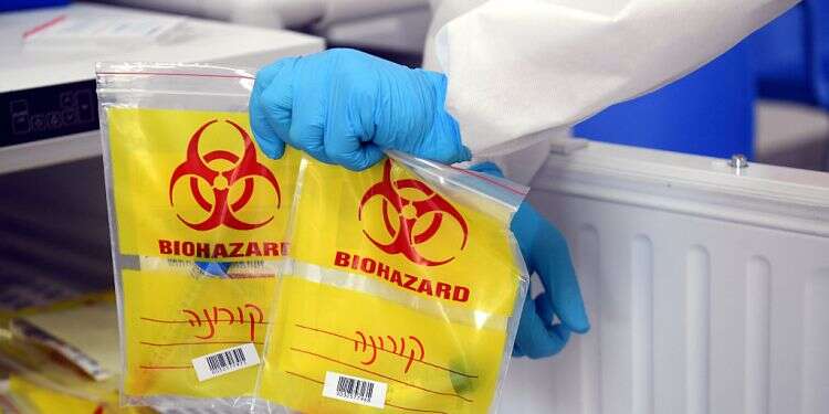 Coronavirus tests being stored in a lab in central Israel Exhausted staff at corona testing labs threatens labor dispute