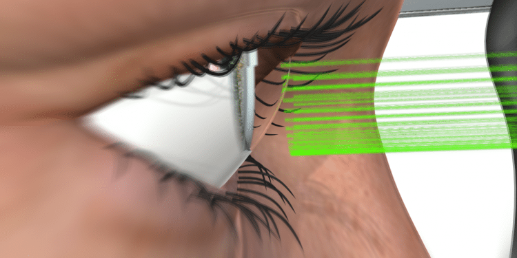 Israeli startup edges closer to 1-second glaucoma treatment