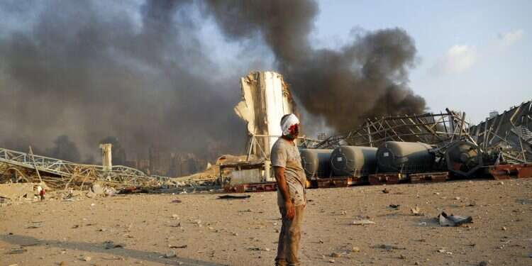 An injured man waits for help after a massive explosion at the seaport of Beirut, Lebanon, Tuesday At least 100 dead, thousands injured as massive blast obliterates Beirut port
