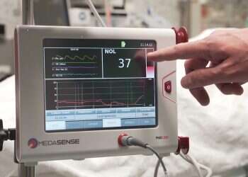 Israeli pain measurement startup helps COVID patients on ventilators