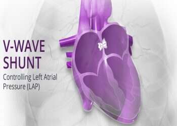 Israeli cardiovascular device developer V-Wave raises $98 million