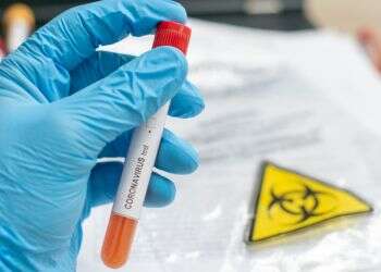 Infection rate soars as nearly 9,000 new corona cases confirmed