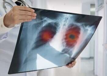 Israeli cancer research firm adds immuno-oncology pioneer to board