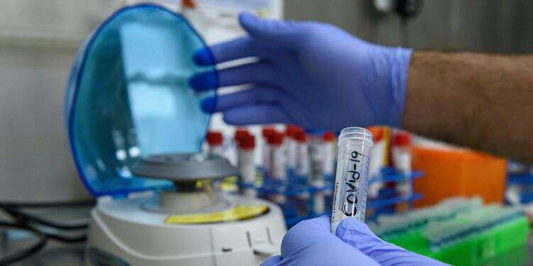 A lab technician perfermoing a coronavirus test Forged coronavirus tests likely to wreak havoc in Jerusalem