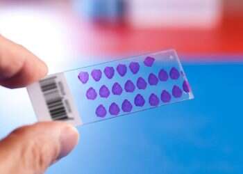 Israel's Ibex cancer diagnostics startup awarded ISO certification