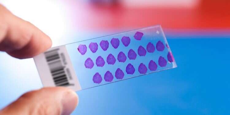 Israel's Ibex cancer diagnostics startup awarded ISO certification