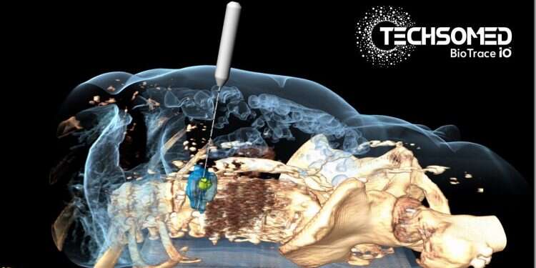TechsoMed imaging technology startup raises $7M