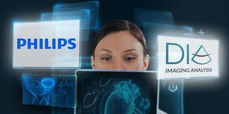 Beersheba-based DiA Imaging Analysis partners with Philips on ultrasound tech
