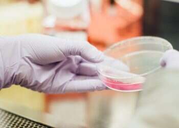 Hadassah Medical Center, MyBiotics collaborate to improve cancer immunotherapy