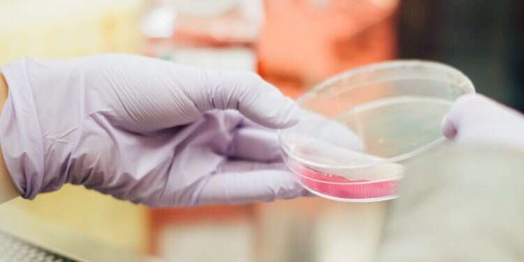 Hadassah Medical Center, MyBiotics collaborate to improve cancer immunotherapy