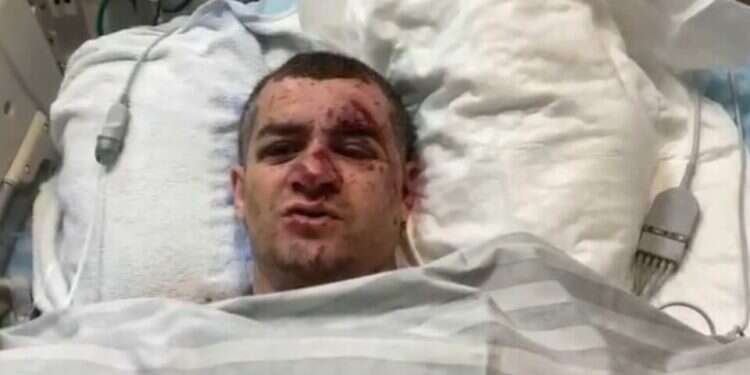 Eyewitness recalls moment Gaza rocket hit his home