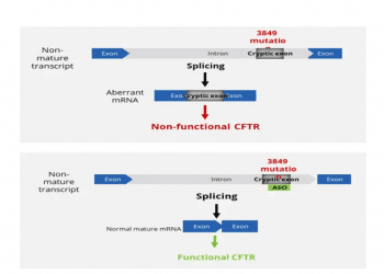 SpliSense bio-tech startup raises $28.5M for cystic fibrosis treatment