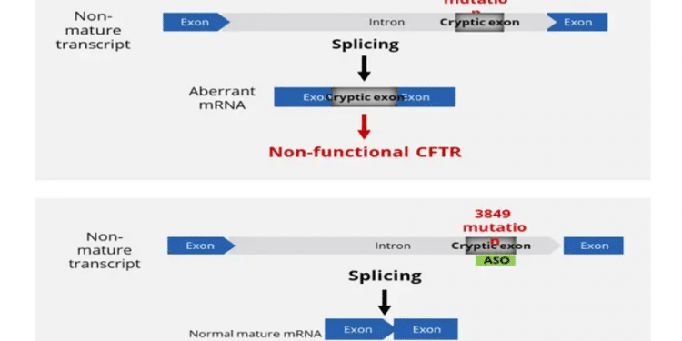SpliSense bio-tech startup raises $28.5M for cystic fibrosis treatment