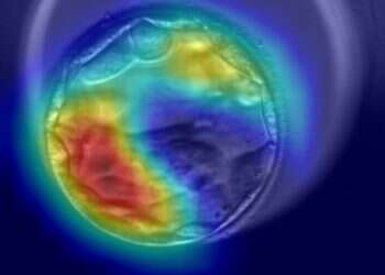 Israeli startup AiVF: Non-invasive AI can ID genetic characteristics in embryos