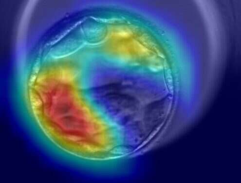 Israeli startup AiVF: Non-invasive AI can ID genetic characteristics in embryos