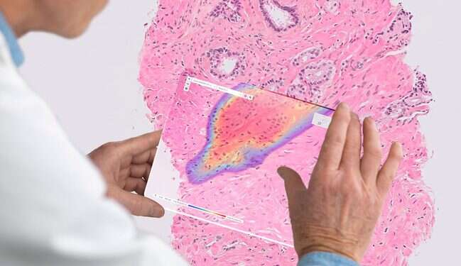 Ibex Medical Analytics uses AI to enable real-time cancer diagnostics AI cancer diagnostics startup Ibex Medical wins FDA breakthrough status