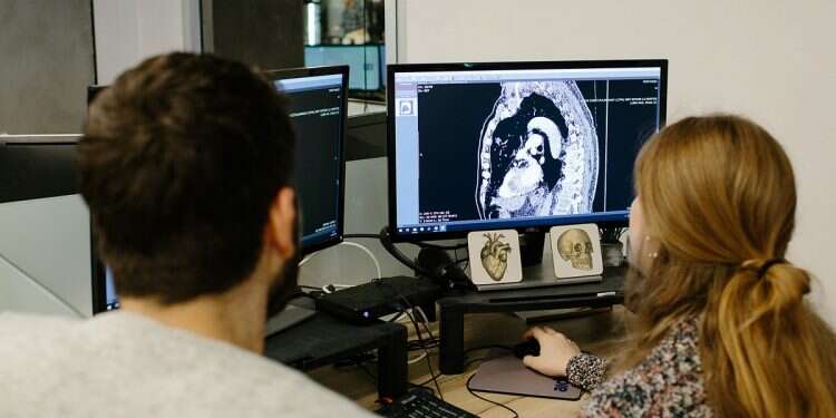 Israeli and American AI imaging equals a new era of early stroke care