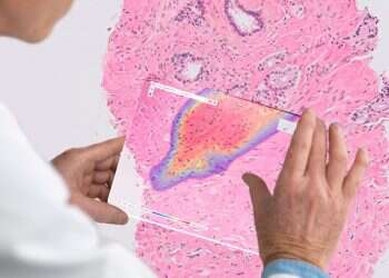 Unilabs signs deal with Israel's Ibex to deploy AI-powered cancer diagnostics &nbsp;