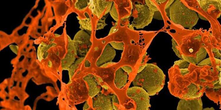 Staphylococcus aureus bacteria that is resistant to the antibiotic methicillin BGU tech transfer arm announces new way of identifying antibiotics resistance