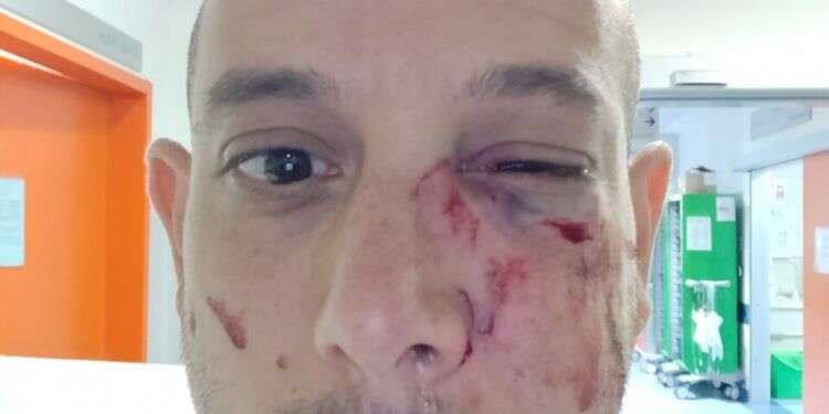 Israeli tourist victim of antisemitic assault in Italy