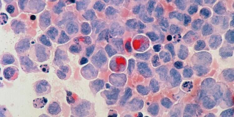 Israeli med tech accelerator offering $1M to 'disrupt' cancer