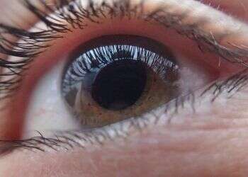 The patient was not a candidate for a synthetic cornea transplant Israeli doctors restore blind woman's vision in breakthrough procedure