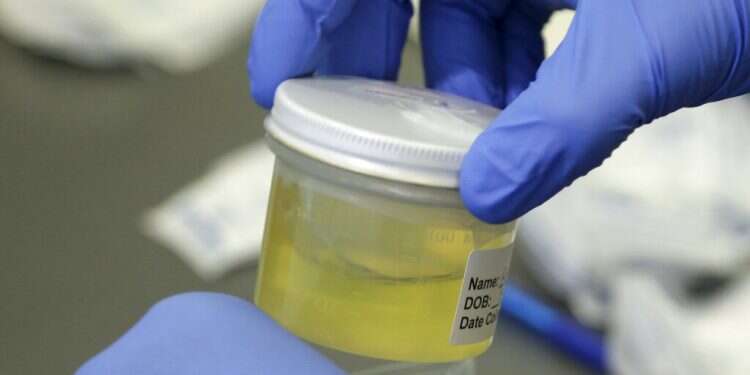 A Florida Department of Health employee processes a urine sample on Sept. 14, 2016 Can a cup of urine a day keep COVID away?