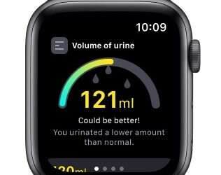 Israeli app displays AI-based urine analysis on Apple Watch