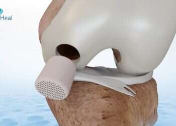 Israeli health VC realizes $500M exit from groundbreaking cartilage startup