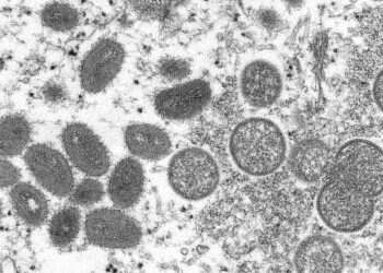 This 2003 electron microscope image made available by the Centers for Disease Control and Prevention shows mature, oval-shaped monkeypox virions, left, and spherical immature virions, right, obtained from a sample of human skin associated with the 2003 prairie dog outbreak Health Ministry urges medical personnel to be on alert for monkeypox
