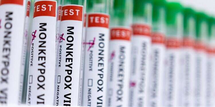 WHO says no urgent need for mass monkeypox vaccination